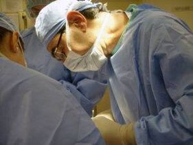 Opération pour augmenter un membre