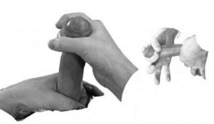 Entorse du pénis pour l'augmenter