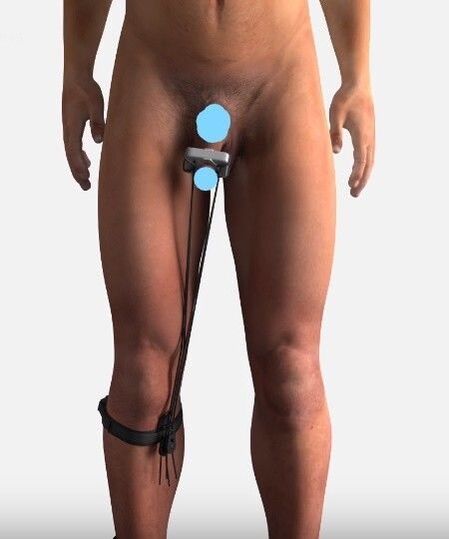 Un appareil pour augmenter un membre